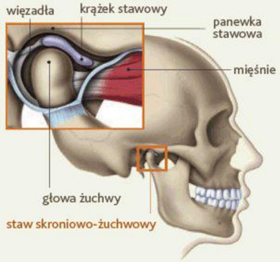 https://www.dentsm.pl/wp-content/uploads/2026/05/staw-skroniowo-zuchwowy1sm.jpg