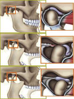 https://www.dentsm.pl/wp-content/uploads/2026/05/staw-skroniowo-zuchwowy2.jpg
