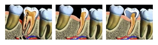 https://www.dentsm.pl/wp-content/uploads/2026/06/hemisekcja_art.jpg