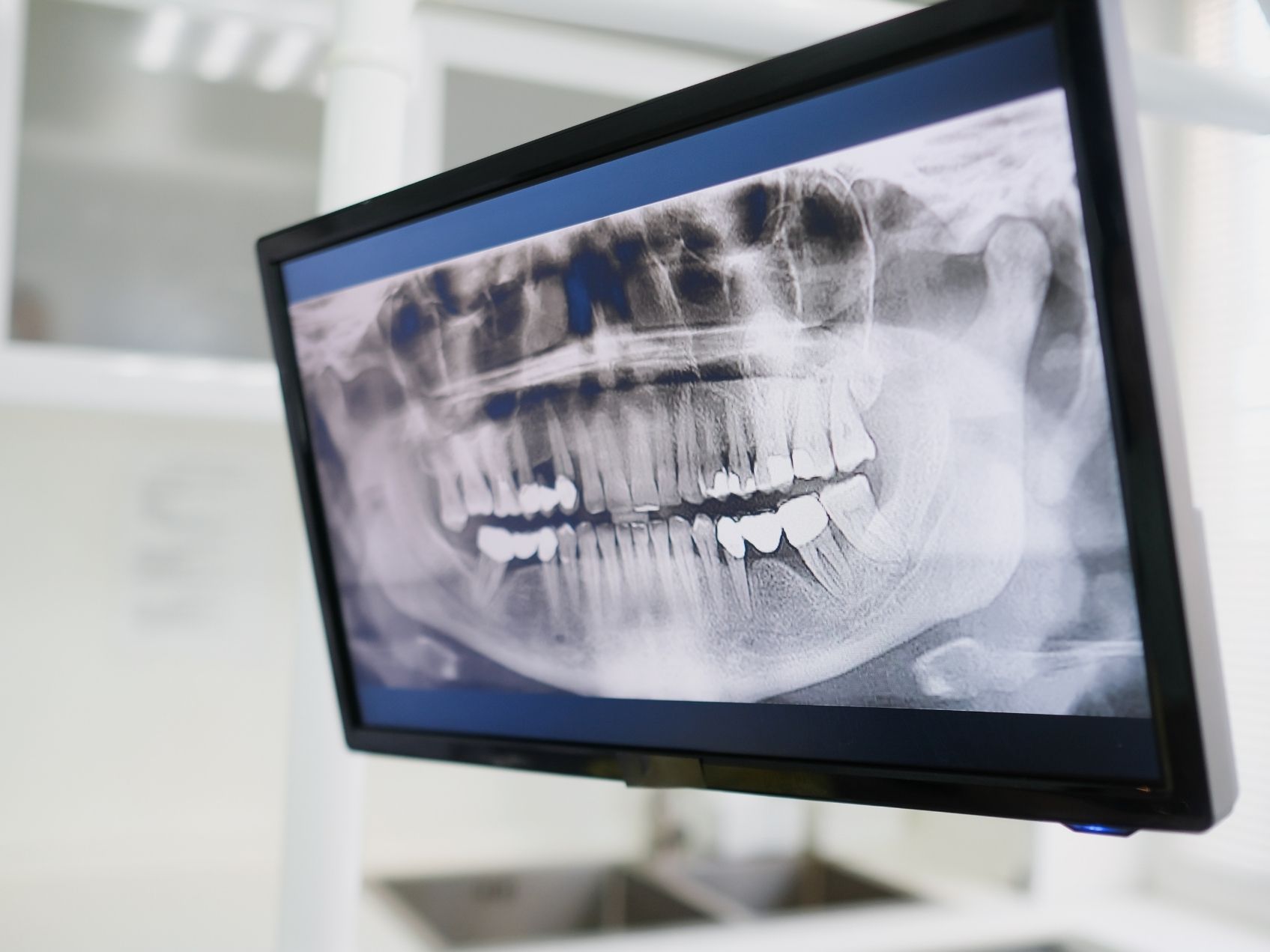 https://www.dentsm.pl/wp-content/uploads/2026/06/nowoczesne-technologie.jpg
